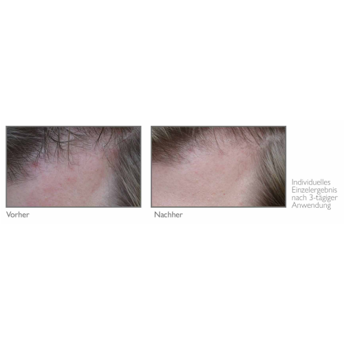 Biocutin® Head Treatment pure 240 ml Kopfhautcreme